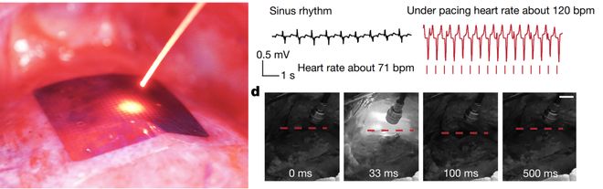 光电生物调控迎重要进展：科学家起搏成年活体猪心脏比上一代材料效率提高约25倍(图2)