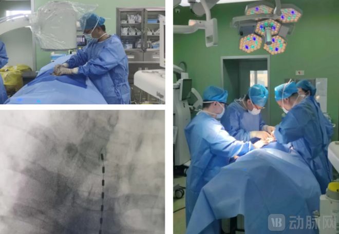 【首发】领创医谷完成近2亿元B轮融资以无线携能+自研芯片打造神经调控全栈平台(图4)