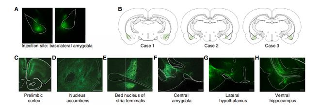 SciAdv：为什么一紧张就心跳加速？科学家揭示基底外侧杏仁核投射神经元多通路协同调控HPA轴应激激活机制(图4)