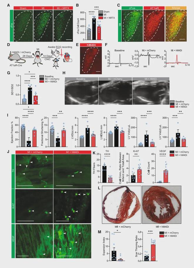 《Cell》靶向心脑轴：心梗精准治疗的新方向！(图5)