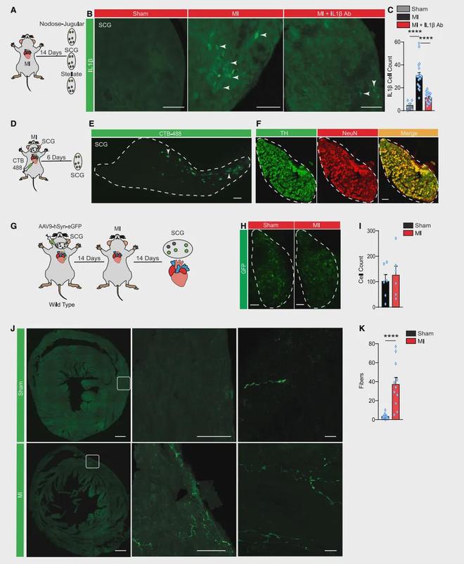《Cell》靶向心脑轴：心梗精准治疗的新方向！(图6)