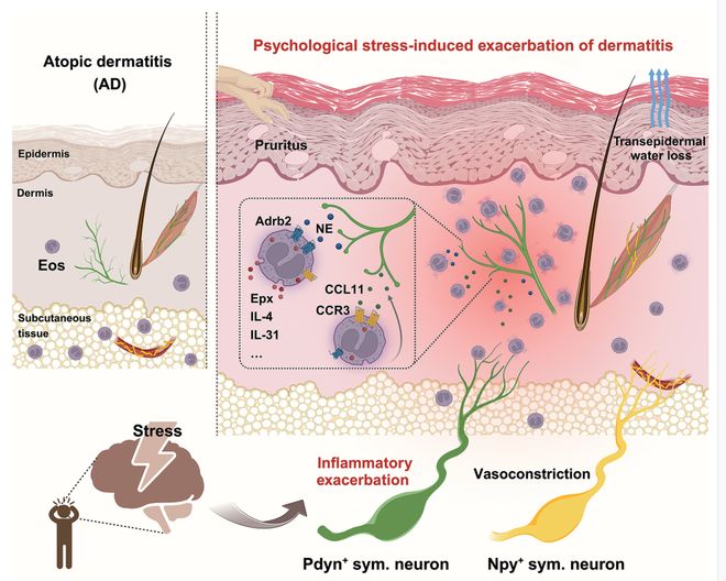 Science：“神经-免疫”轴新突破！复旦柳申滨团队首次揭示心理压力加重湿疹的关键机制(图6)