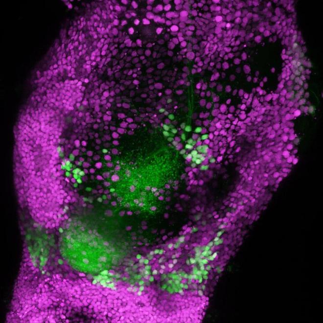 追问daily励志短视频与冥想效果相当；赌博直播如何让人越看越想赌；少量恶意文档即可投毒大型语言模型(图1)