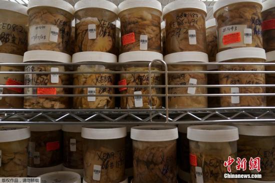 2026年润唇膏行业市场分析及产品选购指南10款热门润唇膏推荐！(图1)