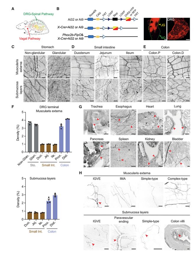 Neuron｜肠道神经如何向大脑喊疼？倪金飞段树民唐逸泉团队揭示小鼠内感受和内脏痛的肠-背根神经节通路(图3)