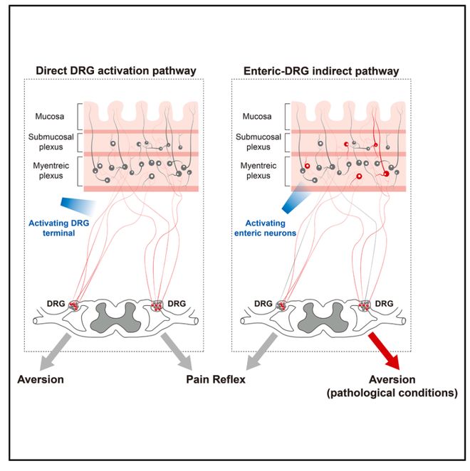 Neuron｜肠道神经如何向大脑喊疼？倪金飞段树民唐逸泉团队揭示小鼠内感受和内脏痛的肠-背根神经节通路(图7)